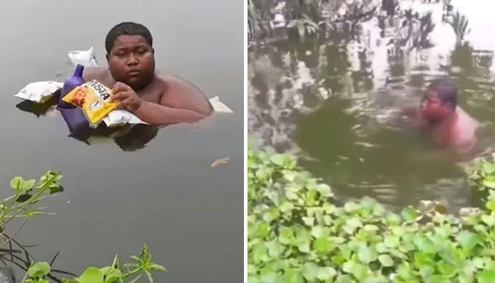 India: 16-year-old youth forced to stay in pool due to severe skin burns