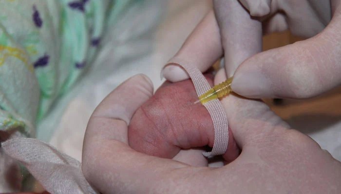 Karachi: A child’s hand was lost due to a wrong cannula, the responsible doctor and staff were not arrested