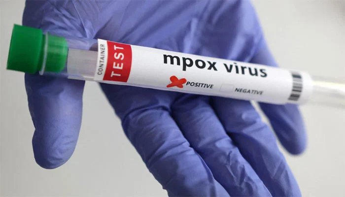 Second case report of m-pox in 2 days in Karachi