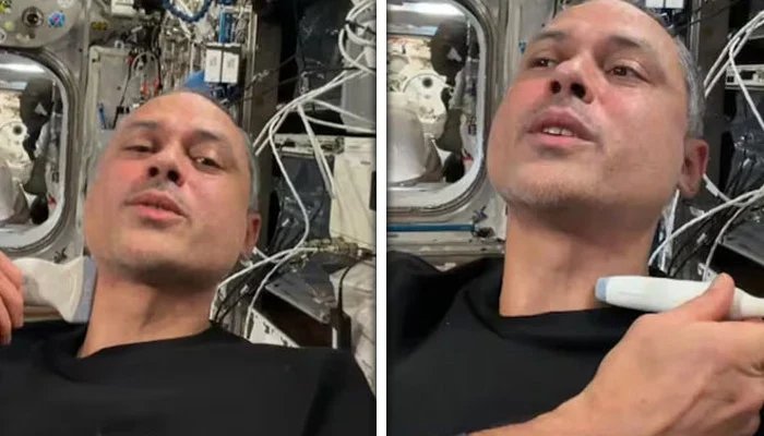 How is ultrasound done in space? Astronaut Anil Menon’s video goes viral
