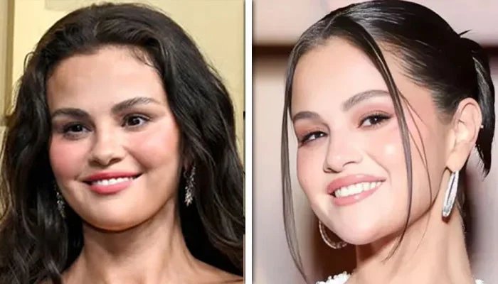 Did selena gomez get cosmetic surgery?